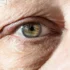 Understanding the Difference Between Under-Eye Bags and Circles